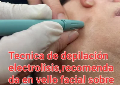 tecnica de cepilacion electrolisis recomendada en el vello facial